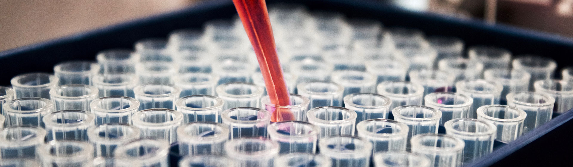 Researcher using a dropper over test tubes